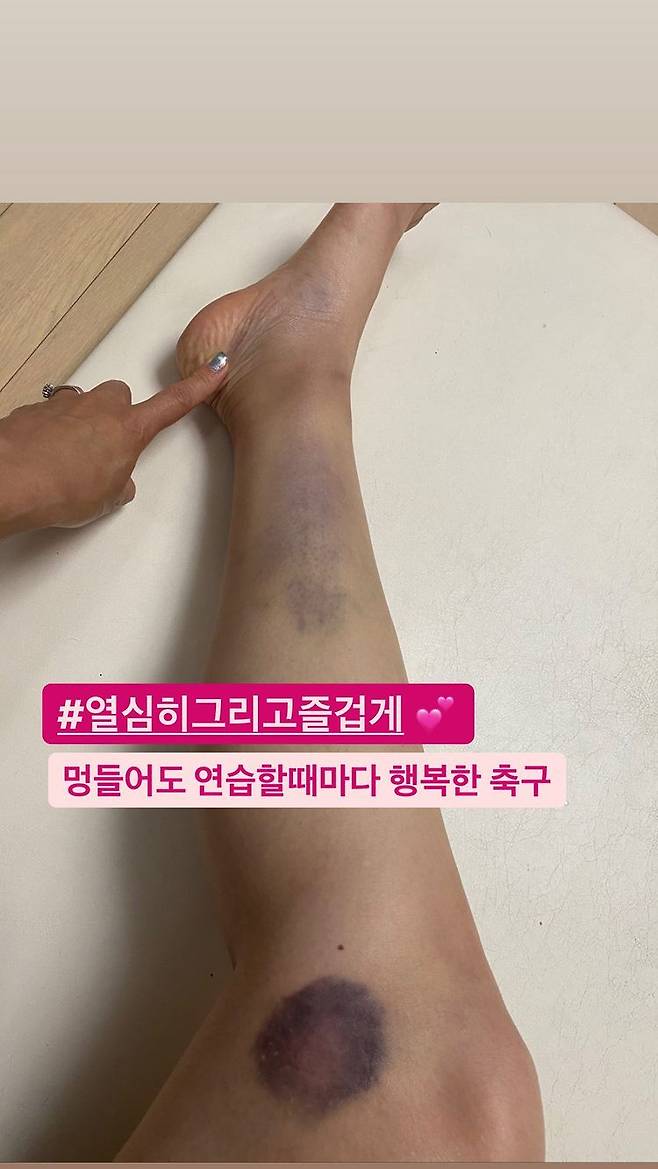 에바 포피엘, 멍투성이 다리 공개…축구 너무 열심히 했나 [스타IN★]