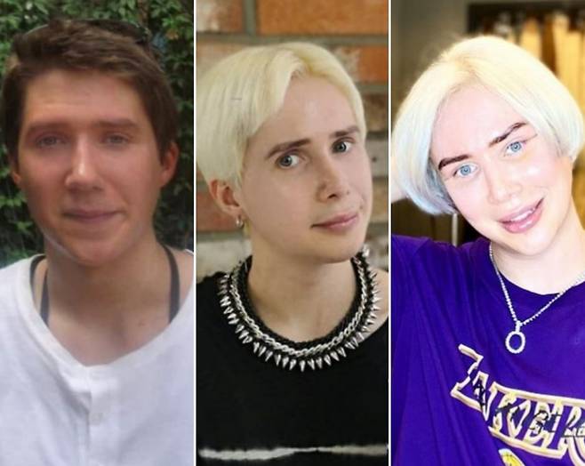 성형 전 2012년(왼쪽)과 2019년(가운데) 올리 런던의 모습. 오른쪽은 성형 후인 지난 6월25일&nbsp;모습. [올리 런던 인스타그램]