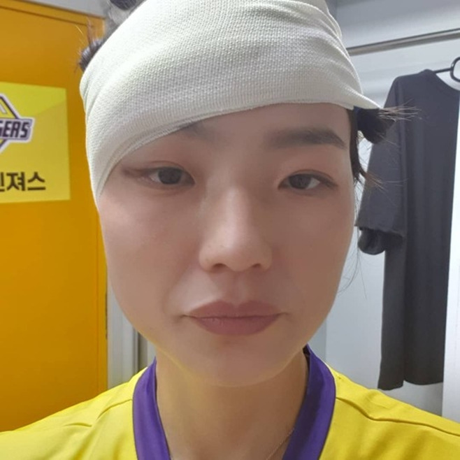 안영미