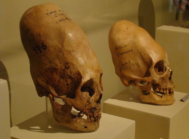 중남미 잉카 유적지에서 발견된 편두 두개골 유골. 위키피디아