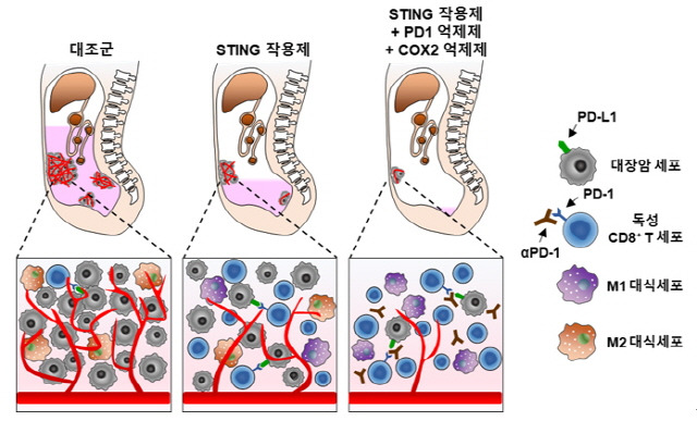 분당차병원 연구팀이 단백질 '스팅'을 이용한 대장암 면역치료법을 개발했다./사진=분당차병원 제공