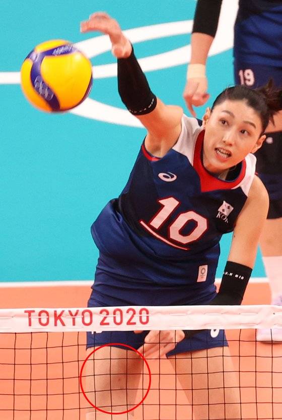 31일 저녁 일본 도쿄 아리아케 아레나에서 열리는 '2020 도쿄올림픽' 여자 배구 A조 조별리그 4차전 대한민국과 일본의 경기를 앞두고 연습중인 김연경의 허벅지에 부상의 흔적(빨간원)이 보인다. 뉴스1
