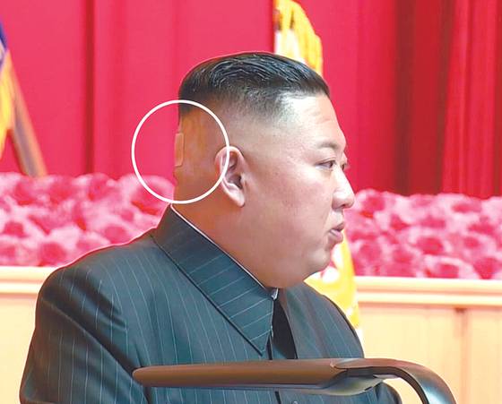 The flesh-colored bandage on the back of North Korean leader Kim Jong-un's head is visible as he speaks to senior military and party officials during a session which lasted four days from July 24 to 27. [KCNA]