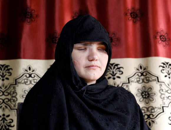 취직했다는 이유로 테러당해 실명한 아프간 여성 경찰 - 직업을 가졌다는 이유로 아버지의 사주를 받은 탈레반 괴한들로부터 두 눈을 공격받아 실명하게 된 아프가니스탄 여성 카테라(33). 카테라는 경찰이 된 지 3개월 만에 끔찍한 범죄 피해를 입고 현재 치료를 받고 있다. 사진은 지난 10월 12일 수도 카불에서 인터뷰하는 모습. 2020.11.11 로이터 연합뉴스