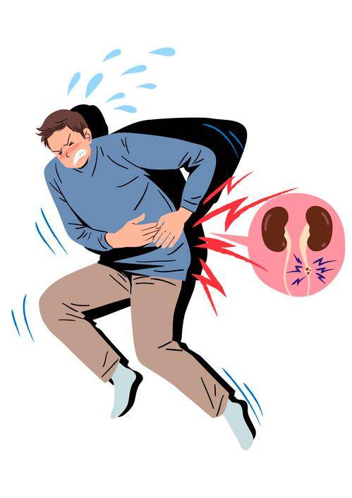 옆구리를 칼로 찌르는 듯한 통증을 유발하는 요로결석은 8월에 가장 많이 발생한다. 게티이미지뱅크