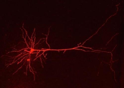 편두통 환자 뇌의 뉴런 편두통 환자의 대상엽 뉴런을 재구성한 이미지.
[스위스 취리히대 제공 / 재판매 및 DB 금지]