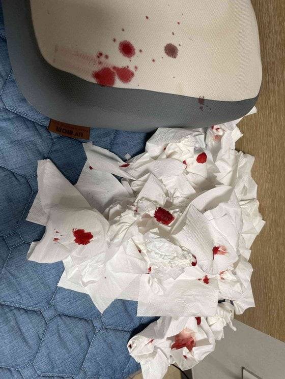 한 백신 접종자가 12일  화이자 백신 접종 후 코피가 멈추지 않는다며 온라인 커뮤니티에 올린 사진/사진=와이고수