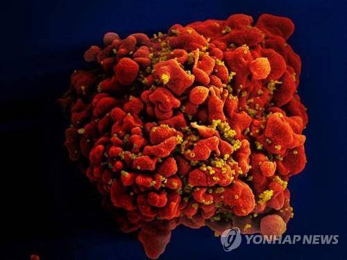 HIV 바이러스에 감염된 인간 백혈구 세포 모습 [미국 국립보건원·NIH 제공 AFP=연합뉴스 자료사진]