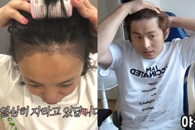 모발 이식을 고백한 배우 고은아, 웹툰 작가 기안84 /사진=유튜브