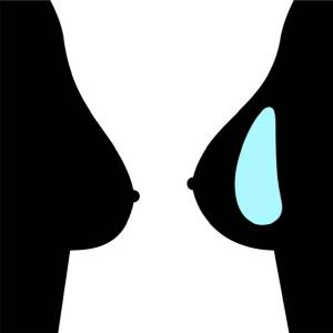 매년 900건 이상의 인공유방 부작용 신고가 발생하고 있다/사진=게티이미지뱅크