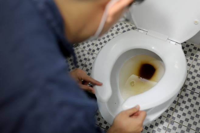 치질은 보통 선홍색 혈변이지만, 대장출혈은 ‘검붉은 색’을 띤다. 하지만 혈변색만으로는 대장암 구별이 어려워 대장전문의 진료로 원인을 확인해야 한다.