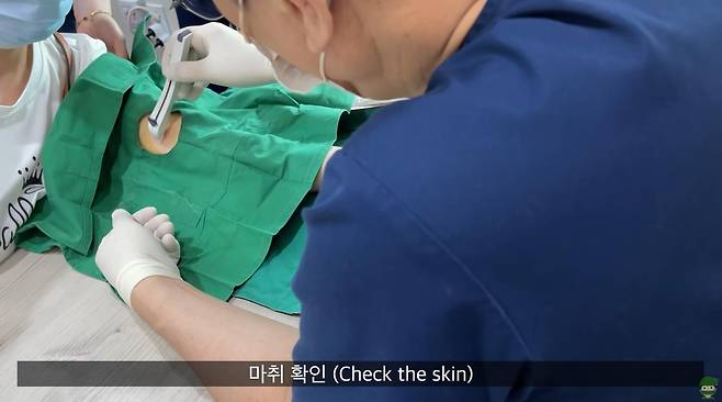 임플라논 시술 보여주는 심상덕 원장 [진오비산부인과 유튜브 캡처. 재판매 및 DB 금지]