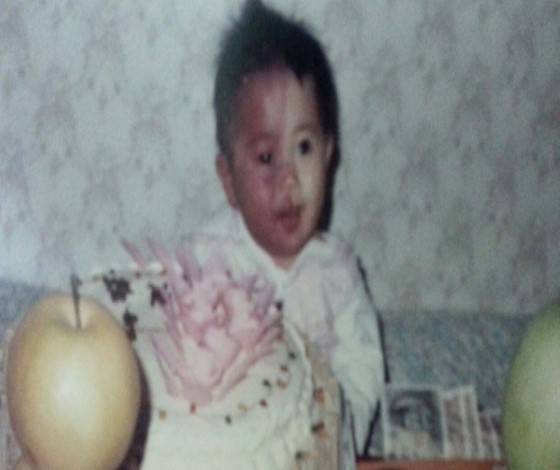 어렸을 때 민혜 님의 사진. 태어날 때부터 오른쪽 얼굴과 팔에 붉은 반점이 있었다. 선천적으로 안면장애를 가지고 있었다./사진=김민혜님
