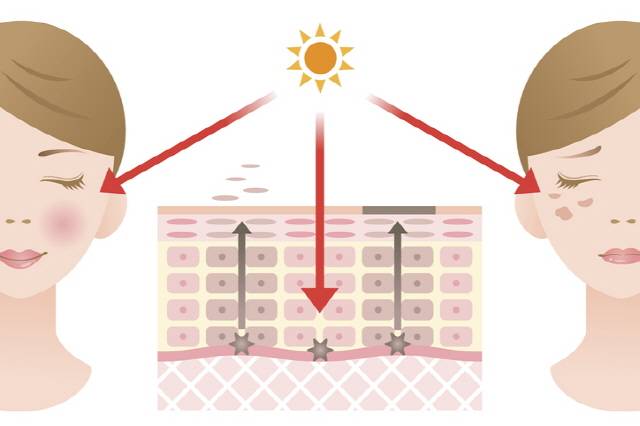 알부틴은 멜라닌 세포 활성화를 억제해 색소침착을 예방, 완화하는 효과를 가져다준다./사진=게티이미지뱅크