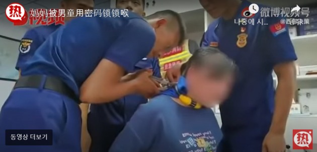중국에서 목에 자전거 자물쇠가 걸린 한 여성의 사연이 화제다. /유튜브 캡쳐