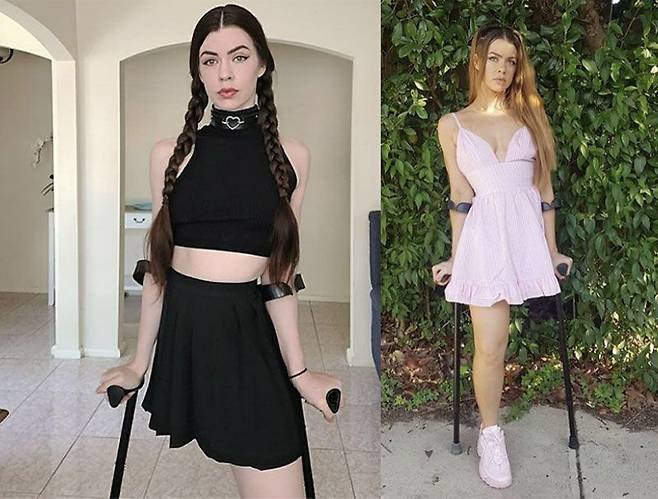 뉴질랜드 출신의 장애인 모델 체리 루이스./Cherie Louise 인스타그램