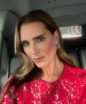 브룩쉴즈는 말단비대증을 앓았다./사진=브룩쉴즈 인스타그램 캡처