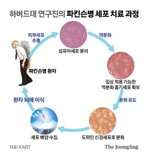하버드대 연구진의 파킨슨병 세포 치료 과정. 그래픽=신재민 기자 shin.jaemin@joongang.co.kr