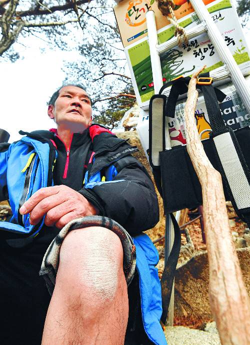 임씨의 왼쪽 무릎에 수십 년 지게꾼 세월을 고스란히 보여주는 굳은 살이 박여 있다.