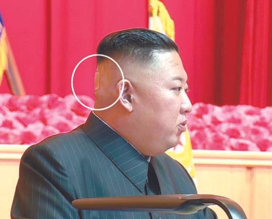 주석단에 앉은 김 위원장이 뒤통수에 손바닥만한 파스를 붙이고 있는 모습이 눈에 띈다. 사진은 김정은 북한 국무위원장이 지난해 7월 전군 지휘관·정치간부 강습을 주재한 모습. 연합뉴스