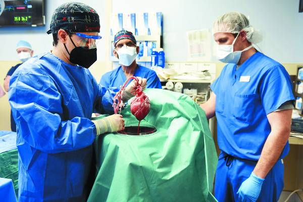 미국 메릴랜드대 메디컬센터 연구진이 지난 7일 말기 심장병 환자인 데이비드 베넷에게 이식할 유전자 변형 돼지 심장을 들어 보이고 있다. 돼지 심장을 사람 몸에 이식하는 수술이 성공한 것은 이번이 처음이다. 로이터연합뉴스