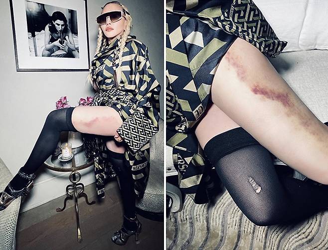 /사진=팝가수 마돈나 인스타그램