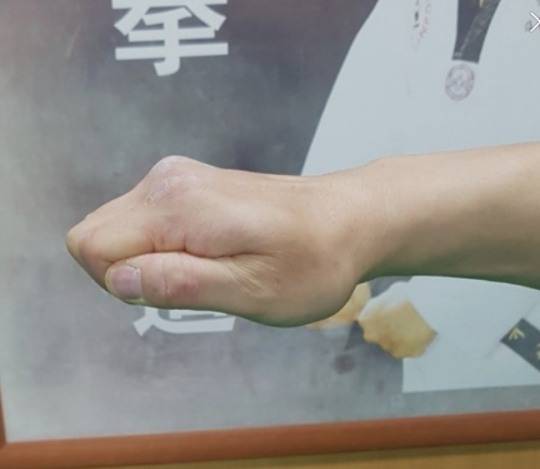 태권도 편주먹 자세. [수지 청우태권도장 블로그 사진]