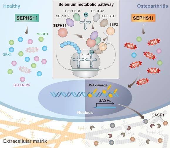 정상 및 퇴행성 관절염 연골세포에서의 활성산소 제거 기전 [서울대 제공. 재판매 및 DB 금지]