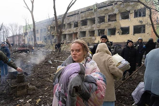 우크라이나 당국은 현재까지 이번 폭격으로 17명이 다쳤다고 파악했다.