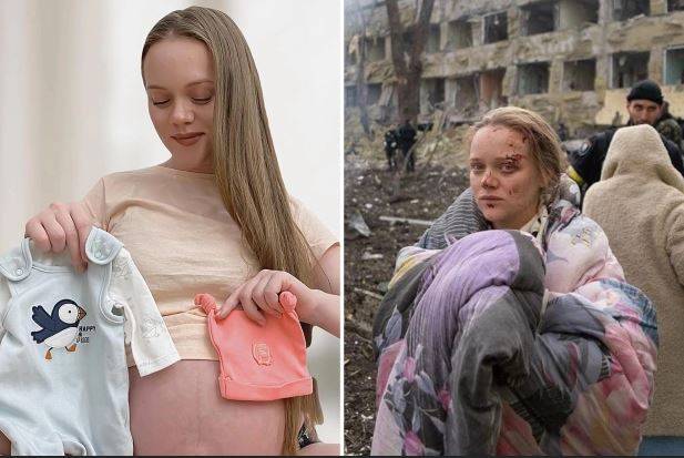 러시아 측이 동일 인물이라고 주장한 배우(왼쪽)와 마리우폴 어린이·산모병원 폭격 당시 피해자의 모습. [더선]