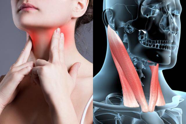 흉쇄유돌근(오른쪽 사진)에 문제가 있을 땐 턱 밑부터 쇄골까지 통증을 느끼게 된다. 게티이미지뱅크
