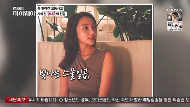 Fitness player Kim Na-yoon mentioned a traffic accident in the past.On March 20th, TV Chosun star documentary myway, a fitness player Kim Na-yoons daily life was revealed.Kim Na-yoon, who worked as a hair designer before the accident, said, I started my career at the age of 17. I lived with my work as a top priority.I remember everything because I didnt lose my memory at the time of the accident. It was the first heat wave. It was hot and hot.I paid a monthly rent to the company and left for Chuncheon with a light heart because I was not long on vacation or vacation due to the nature of my job, and I left for Chuncheon.I was going and I slipped on the national highway and rolled, he recalled.I thought I just fell, but I could not get up. Friend came and cried because I had no arms. I wanted to hear it wrong.I felt like I didnt have a real arm, and I couldnt move, because my arm was amputated and I was blown away, and I couldnt get up because I had 19 fractures from the cervical vertebrae to the thoracic vertebrae.I asked Friend to find my arm because I thought I could not rot enough to join, and Friend came to me. I went to the emergency room in the neighborhood. I was told that there was a difficulty in operating because my arm was too damaged, but I was able to do it because of sepsis.For a hairdresser, the left hand is a very important role: most of the time, the pilot and angle are controlled by the left hand, and my goals, dreams, and all that I have done have been lost.I cried a lot. If Sudan was not a motorcycle, I would have had an accident. Whose fault was it?I didnt think it would be the right answer to not think about it. If Id been grateful, Id have died instantly.I was right-handed, but my left arm was cut off, so I was grateful. 