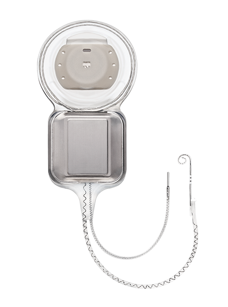 귀 뒤쪽 두개골에 이식되는 인공와우 임플란트. 연결된 전극은 달팽이관에 삽입된다. 코클리어코리아 제공