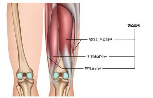햄스트링 근육의 위치와 모양. 허벅지 뒤쪽에 햄스트링 근육이 자리 잡고 있다. 내측에는 반힘줄모양근과 반막모양근이, 외측에는 넙다리 두갈래근이 있다./사진=대한스포츠의학회