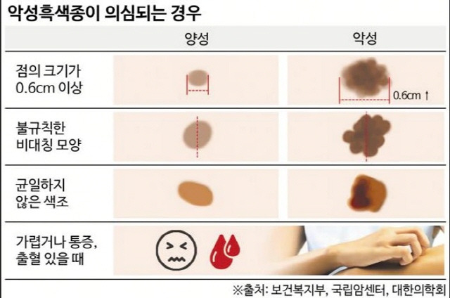 조선일보DB