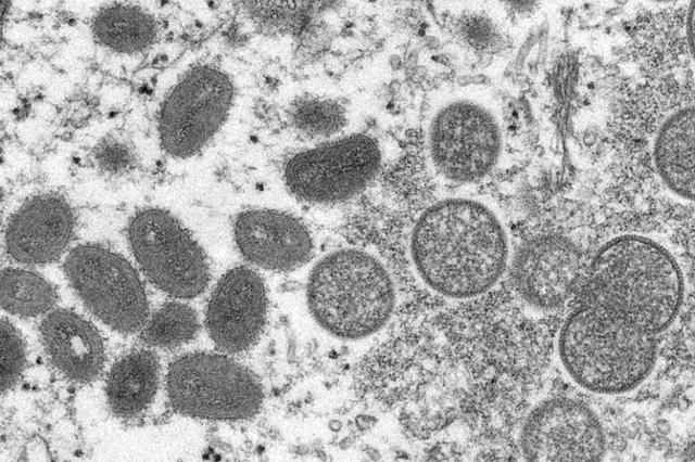 원숭이두창에 감염된 세포를 전자현미경으로 확대한 이미지. CDC 제공