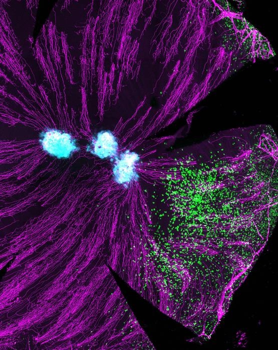 각막에 발현한 T세포  각막에 들어오는 T세포(녹색).
연청색은 HSV 감염 세포. 안구에 많이 분포된 신경은 자주색으로 보인다.
[호주 멜버른대 도허티 연구소 제공. 재판매 및 DB 금지]