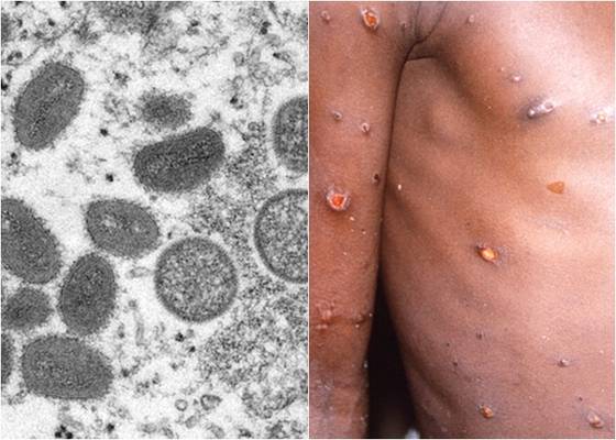 〈사진=로이터 연합뉴스〉