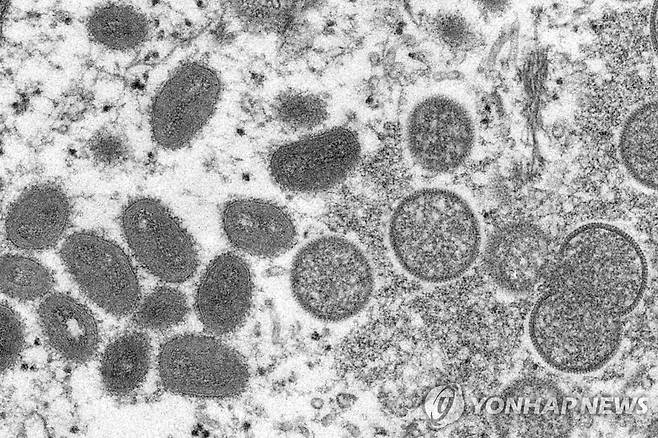 원숭이두창 바이러스 입자 전자현미경 이미지. [AP 연합뉴스 자료사진. 재판매 및 DB 금지]