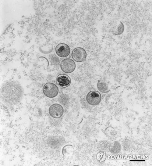 전자현미경에 포착된 원숭이두창 바이러스 [AFP 연합뉴스 자료사진. 재판매 및 DB 금지]