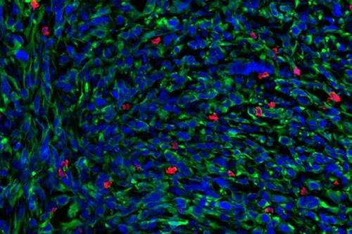 암 종양에 발현한 T세포 면역형광법으로 촬영한 암 종양의 전자현미경 이미지.
종양(녹색)에 나타난 T세포(적색)와 암세포 핵(청색)이 뚜렷이 보인다.
[미국 MIT(매사추세츠공대) Elen Torres-Mejia 제공. 재판매 및 DB 금지]