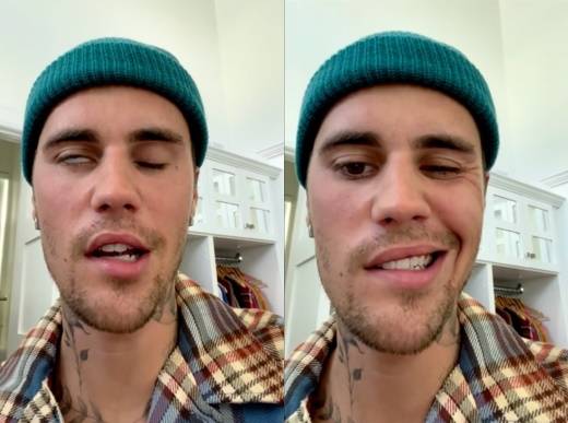 팝스타 저스틴 비버가 안면 마비로 인한 고통을 호소했다. [사진=저스틴 비버 SNS 영상 캡처]