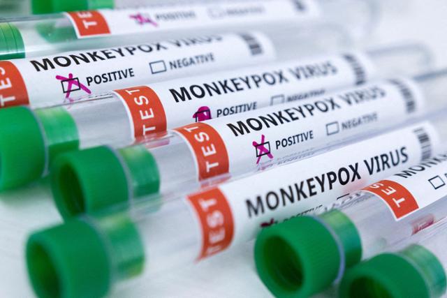 원숭이두창 감염 테스트에서 '양성'이라고 확진된 샘플이 놓여 있는 모습. 로이터 연합뉴스