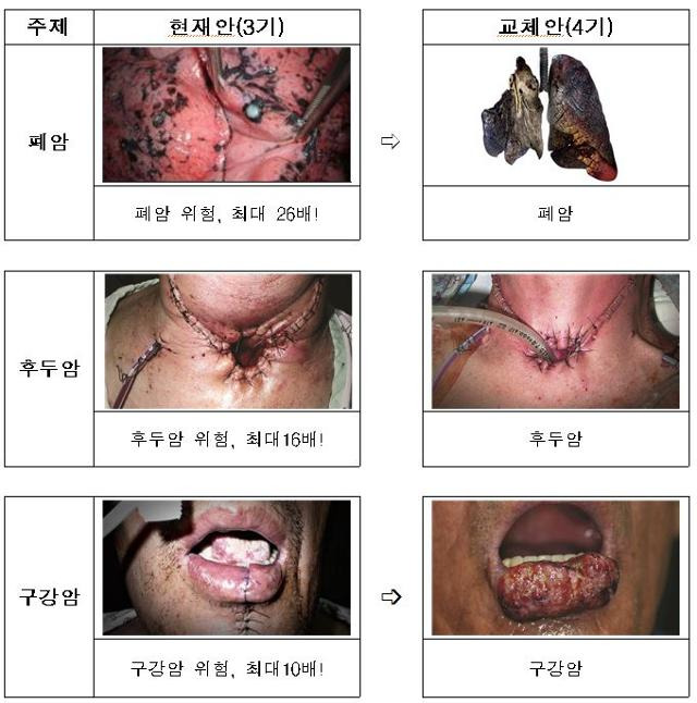 보건복지부가 20일 확정한 '4기 담뱃갑 경고 그림 및 문구'. 왼쪽은 현행 3기 그림, 문구이며 오른쪽은 12월 23일부터 바뀌는 4기 그림, 문구다. 보건복지부 제공