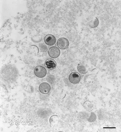 원숭이 두창 바이러스를 독일 로베르트 코흐 연구소(RKI)가 2004년 전자현미경으로 촬영한 사진. 베를린 | AFP연합뉴스
