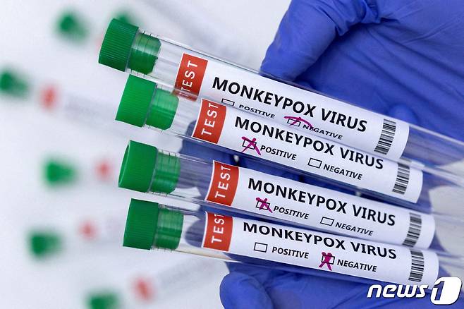 원숭이두창 감염 검사 키트. © 로이터=뉴스1 © News1 원태성 기자
