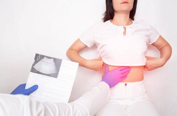 비알코올성 지방간이 근손실에도 영향을 미치는 것으로 나타났다. [사진=게티이미지뱅크]