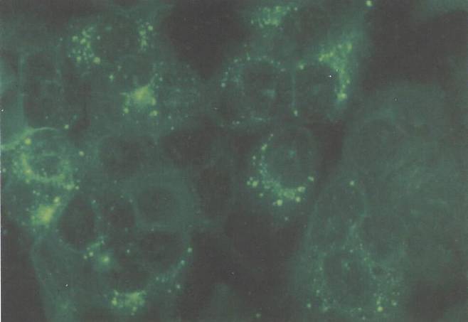 한탄바이러스에 감염된 베로 세포의 형광현미경 사진. 출처=’한타바이러스학’