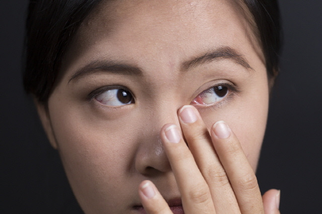 눈곱이 전보다 많이 생긴다면 염증이나 건성안을 의심해봐야 한다./ 사진=게티이미지뱅크