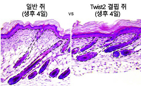 Twist2 전사인자가 결핍된 쥐와 일반 쥐의 피부 비교. Twist2 전사인자가 결핍된 쥐는 일반 쥐보다 다수의 진피 줄기세포가 빽빽하게 밀집되고 지방층을 포함한 피부 두께는 얇았으나, 표피와 모낭 조직은 계속 자라나고 있었다.